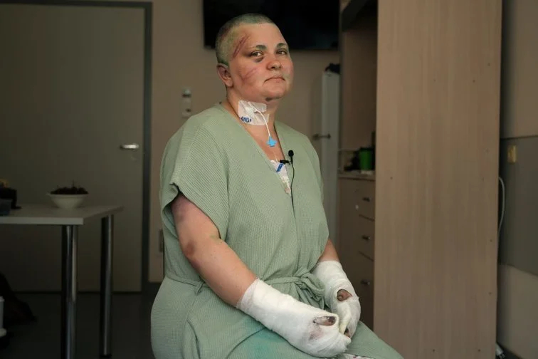 Yelena Milashina after her brutal attack in 2023. Photo: Abubakar Yangulbaev