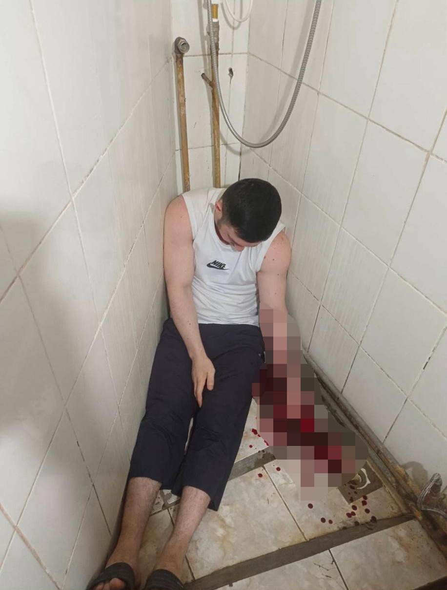 Мансур Мовлаев после попытки самоубийства. Фото предоставил Вадим Дроздов