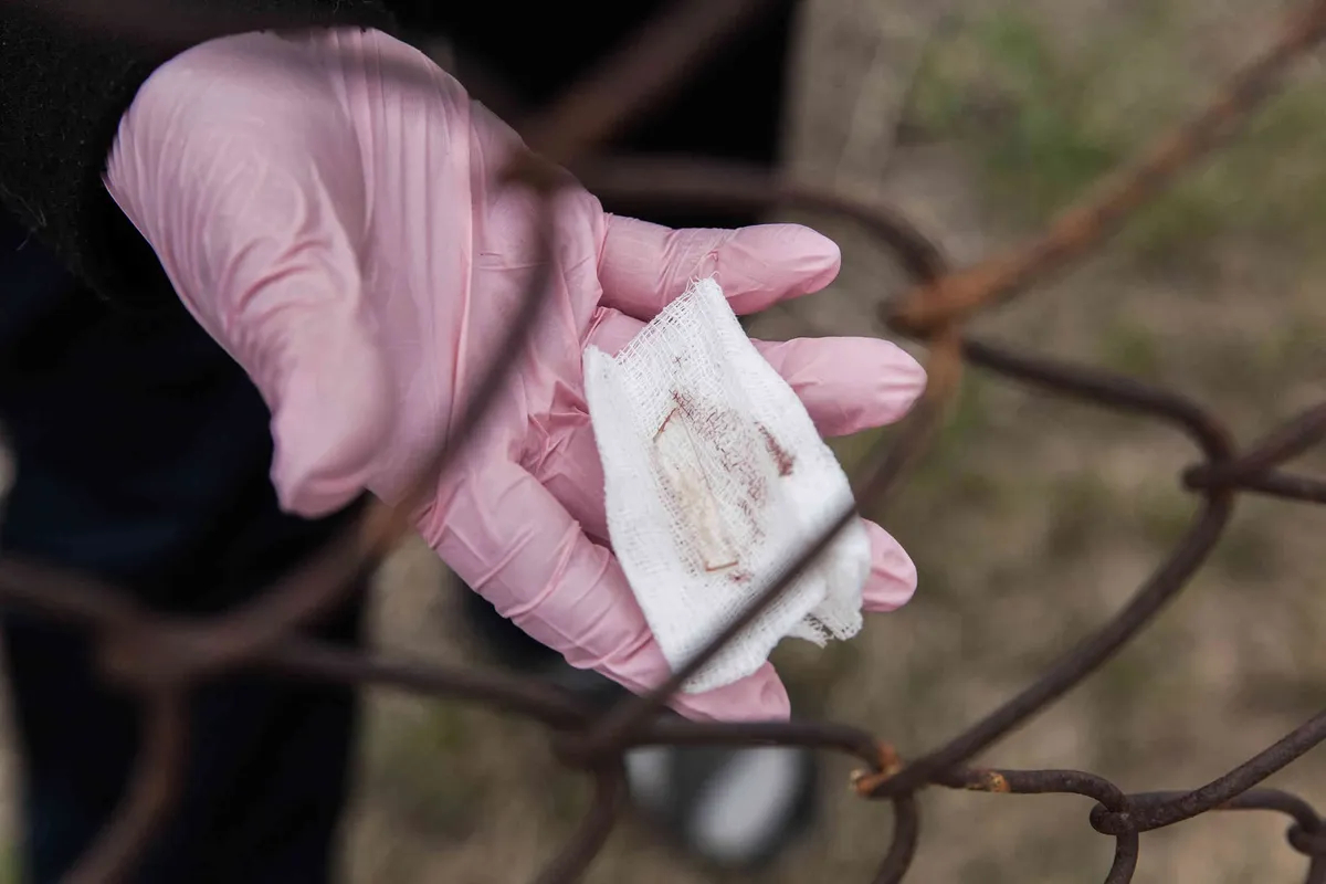 Rimma Kalinina showing a glass fragment she had removed from her leg. Photo: Nikolay Kozhevnikov, exclusively for Novaya Gazeta Europe